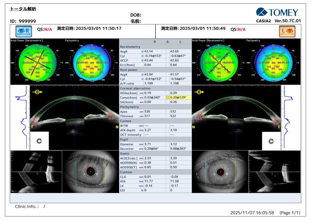 角膜の形を検査機器で測定した結果を表す画像